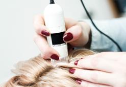 As doenças do couro cabeludo mais comuns. Causas e tipos
